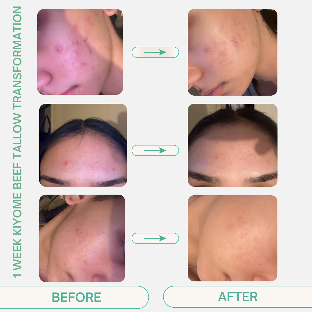 Pure Japanese Grass-Fed Beef Tallow