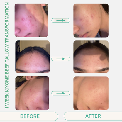 Pure Japanese Grass-Fed Beef Tallow